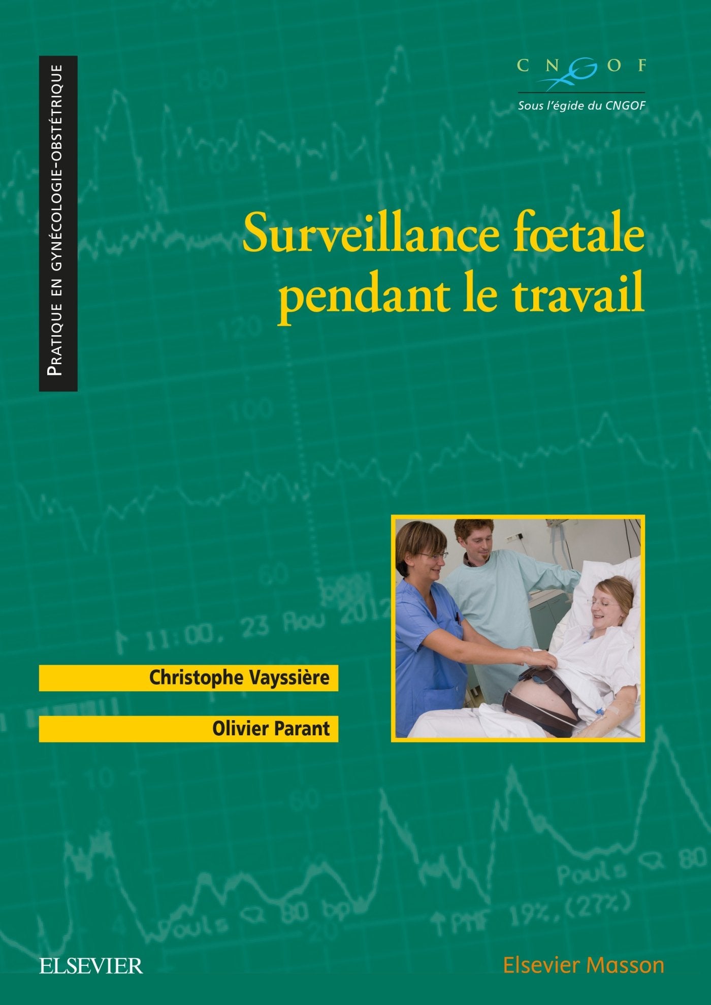 Surveillance foetale pendant le travail book
