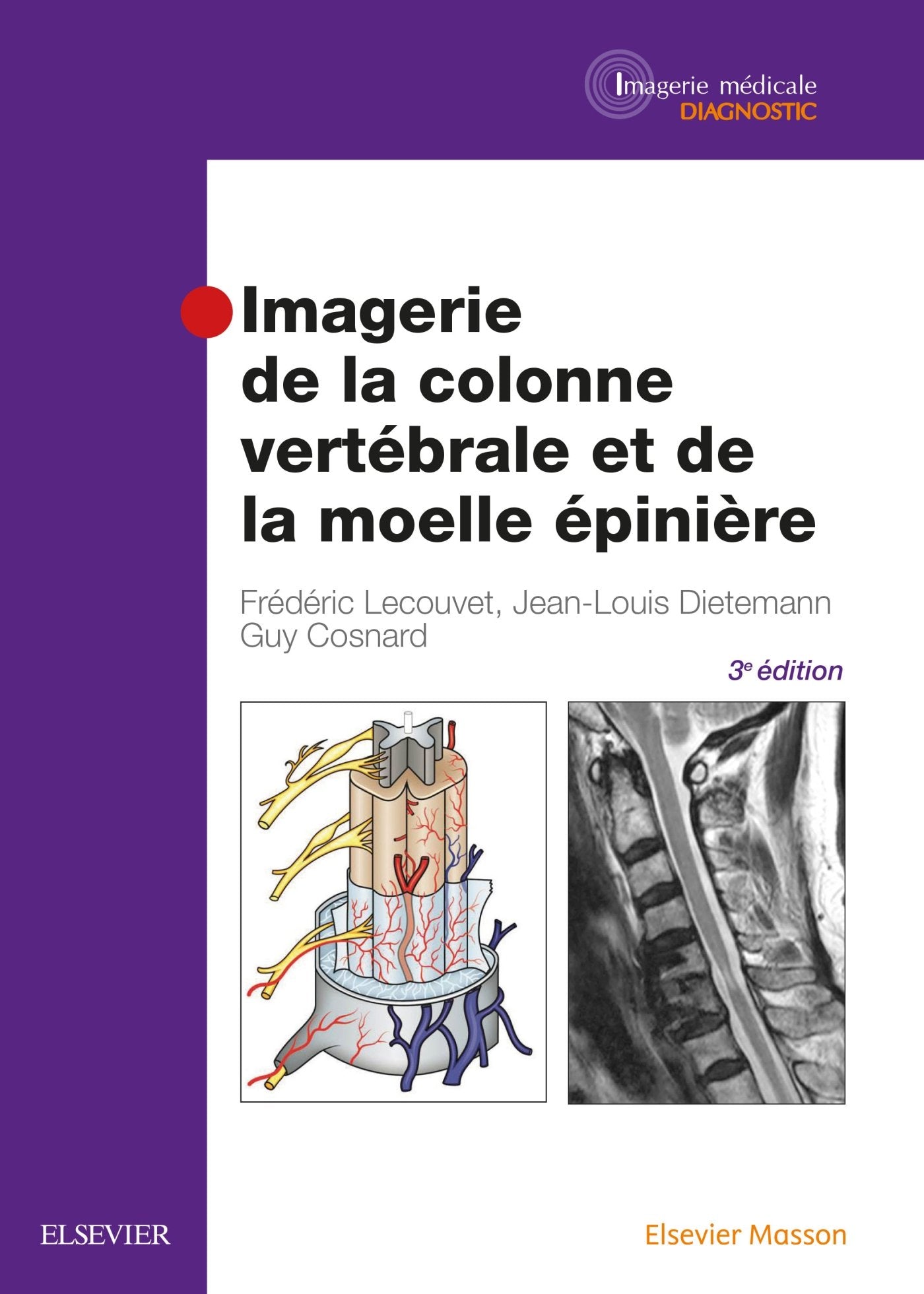 Imagerie de la colonne vertébrale et de la moelle épinière book