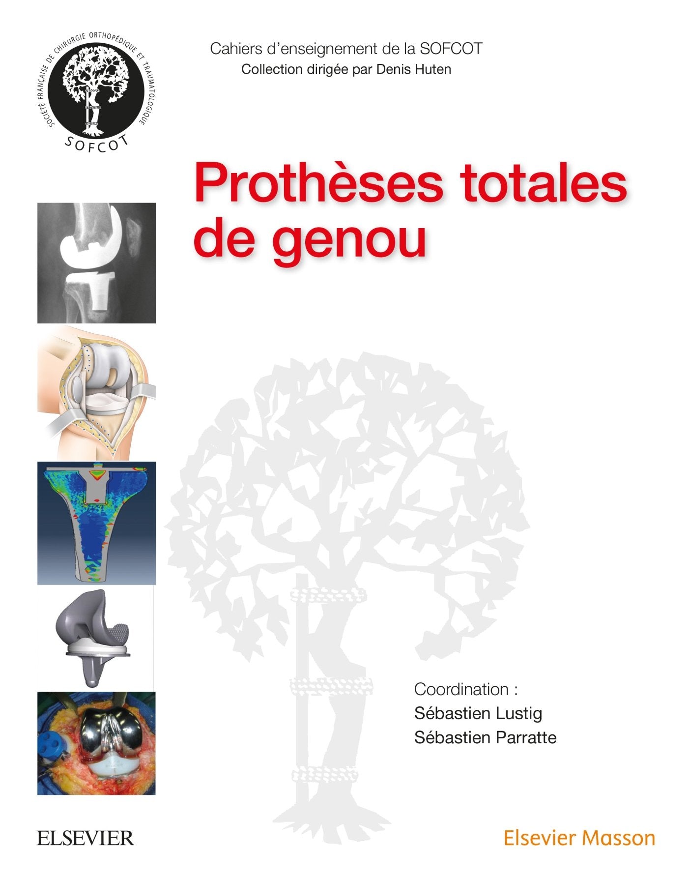 Prothèses Totales De Genou Medicine