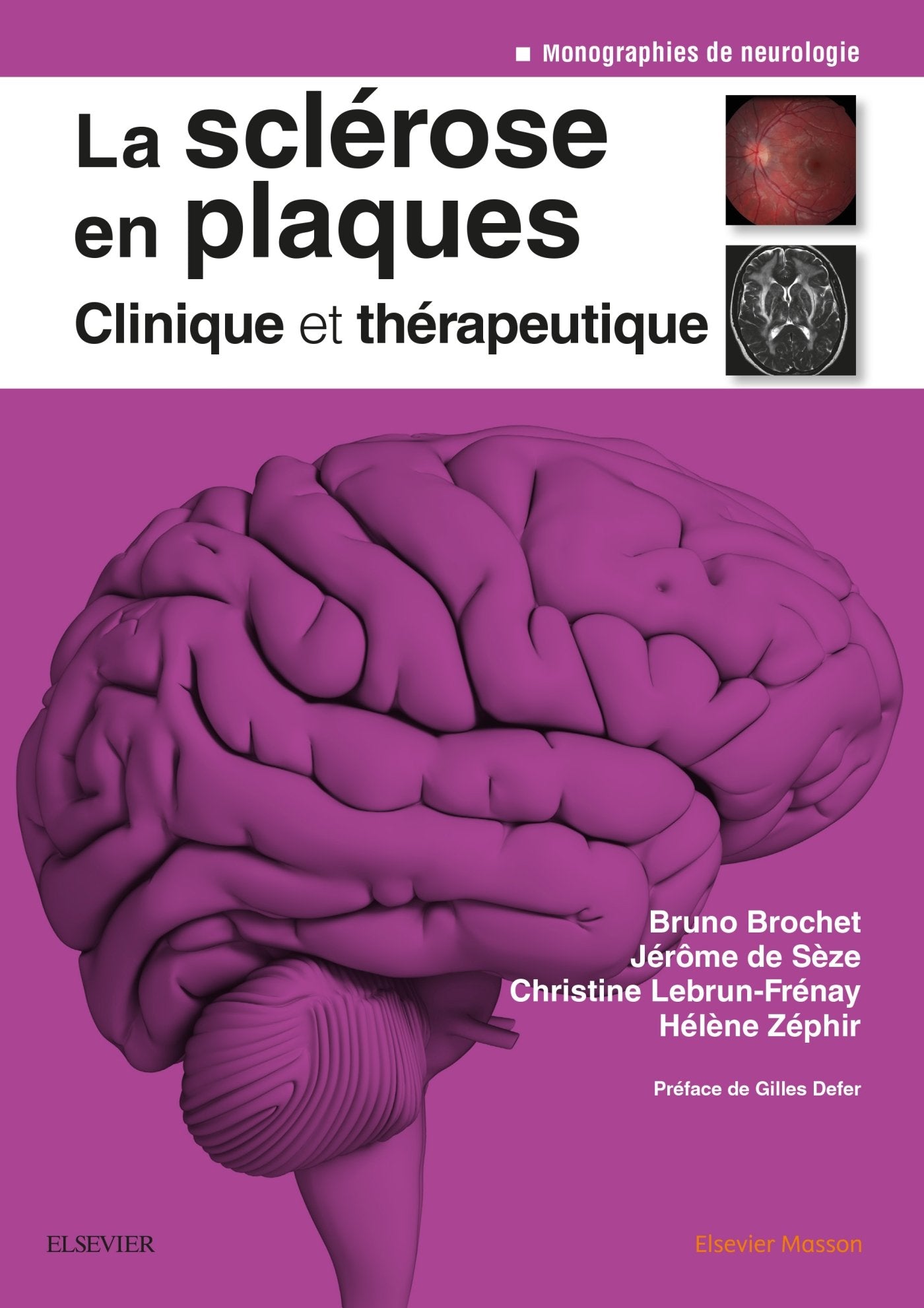 La sclérose en plaques - Clinique et thérapeutique book