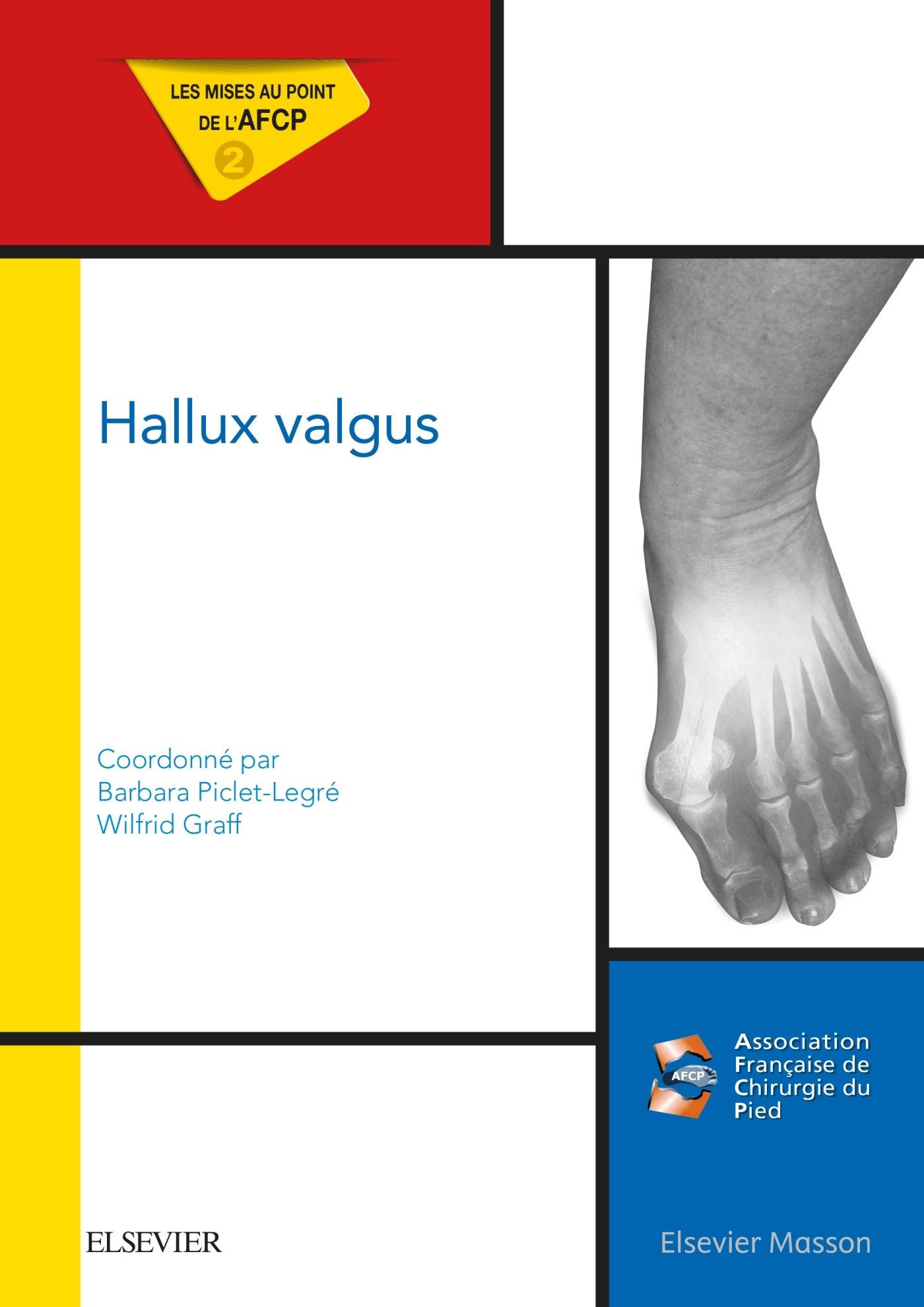 Hallux valgus: Mises au point de l'AFCP book