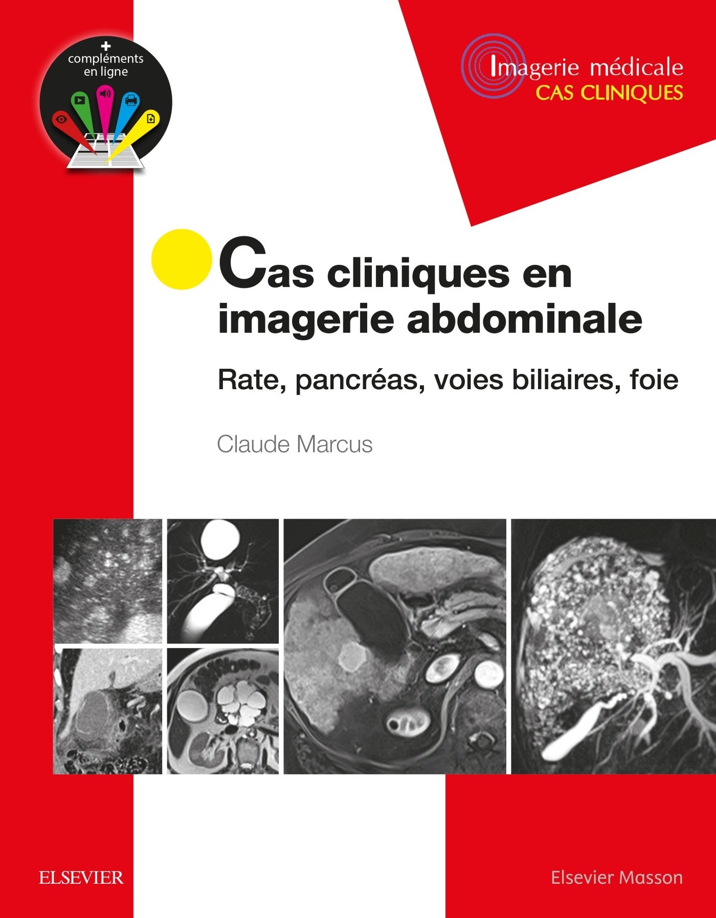 Cas Cliniques En Imagerie Abdominale: Rate, Pancréas, Voies Biliaires, Foie (Imagerie Medicale Cas Cliniques) Medicine