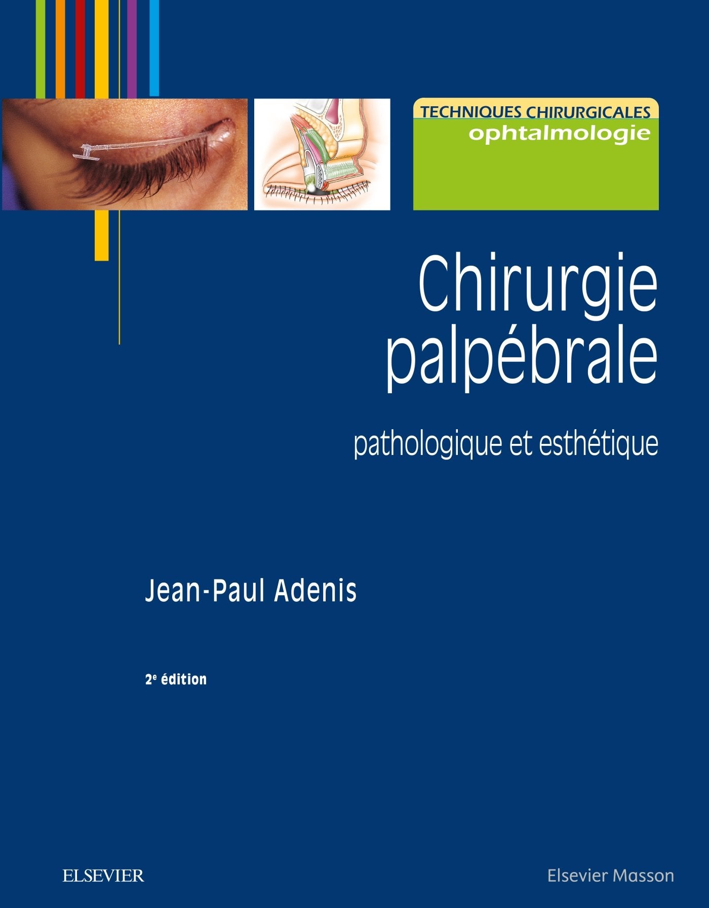 Chirurgie palpébrale: pathologique et esthétique book