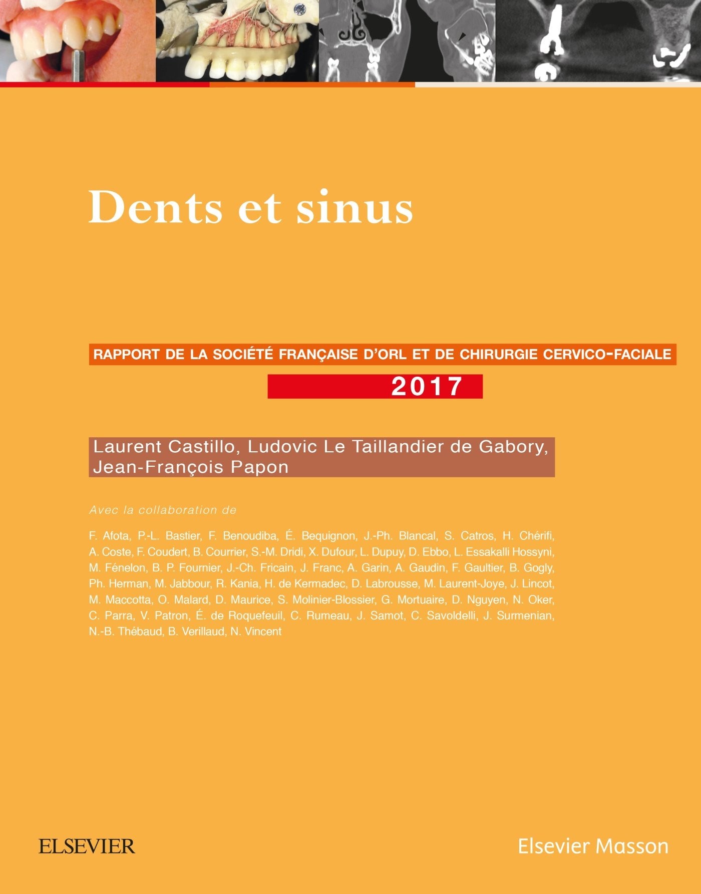 Dents Et Sinus: Rapport Sforl 2017 Medicine