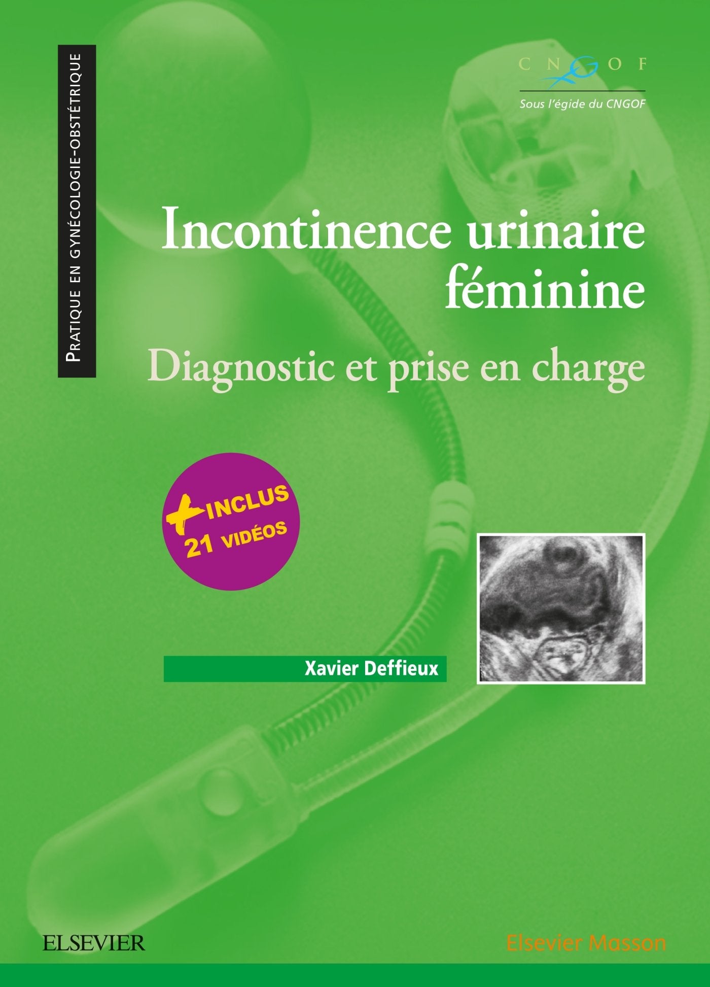 Incontinence urinaire féminine: Diagnostic et prise en charge Medicine