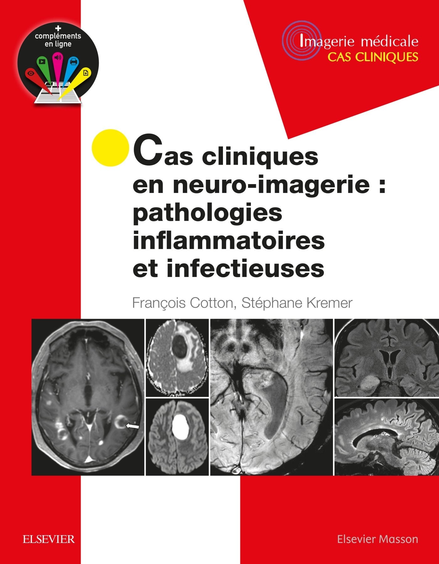 Cas cliniques en neuro-imagerie : pathologies inflammatoires et infectieuses: Path Inflammat Et Infectieuses Medicine