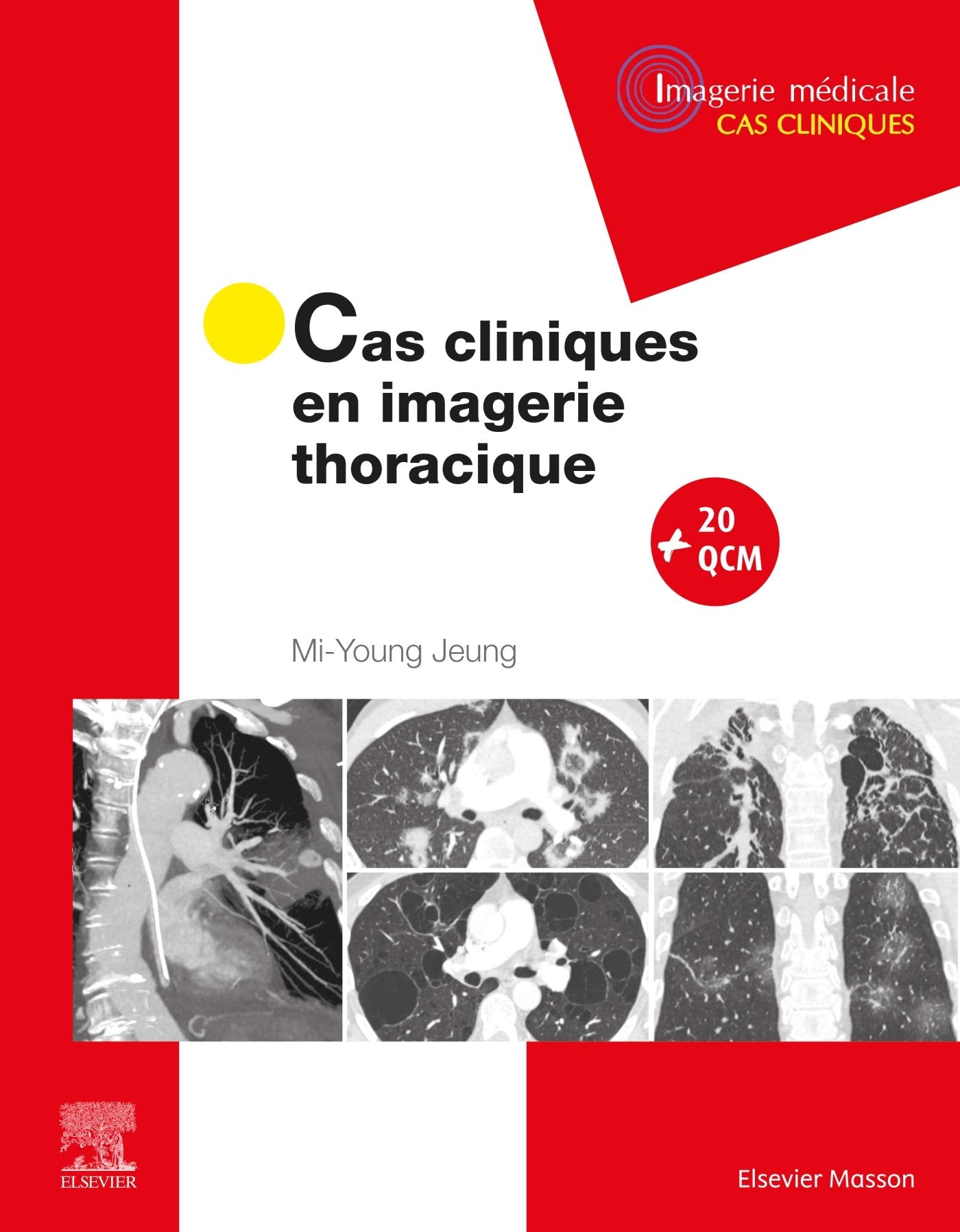 Cas cliniques en imagerie thoracique book