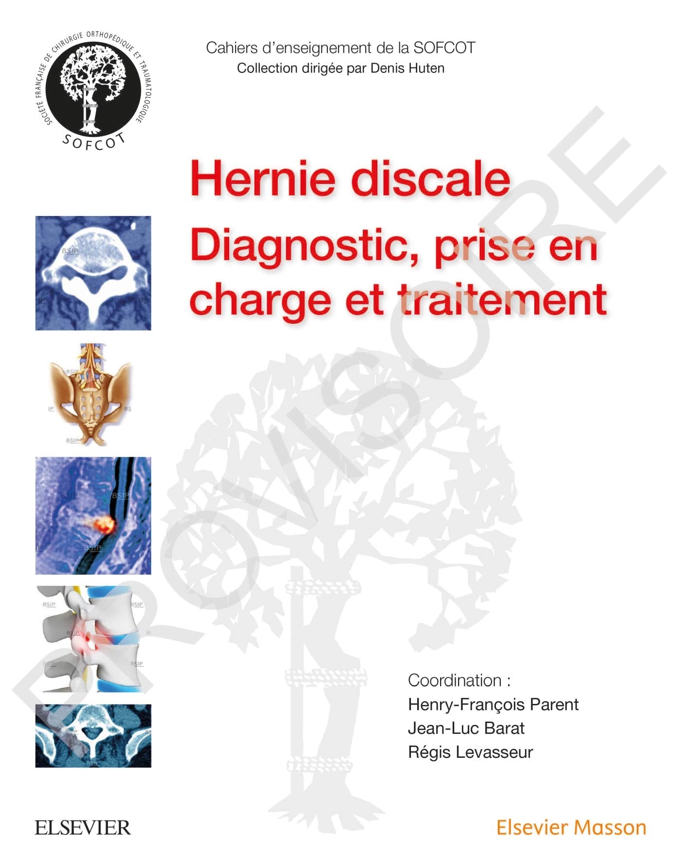 La hernie discale lombaire: Diagn,Prise En Ch Et Traitemt Medicine