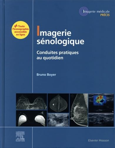 Imagerie sénologique: Conduites pratiques au quotidien Medicine