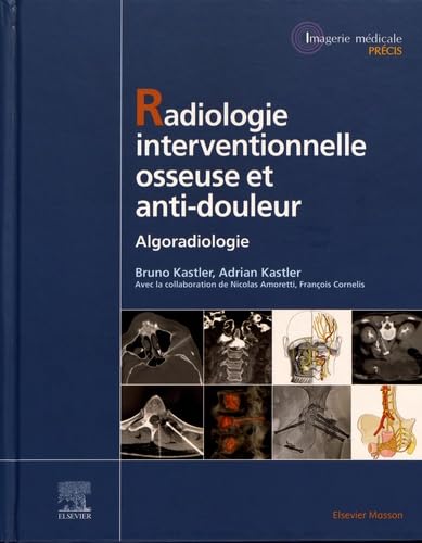 Radiologie Interventionnelle osseuse et anti-douleur: Algoradiologie book
