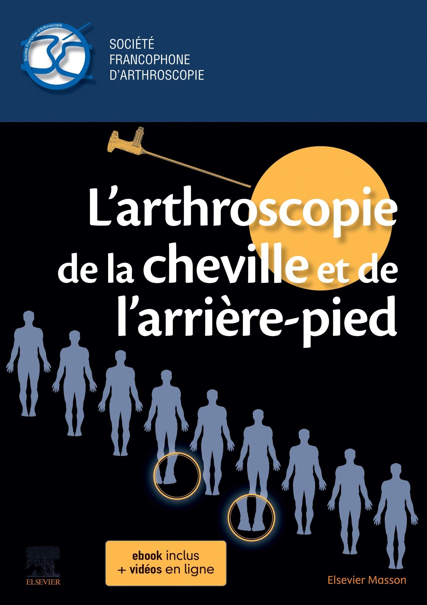 L'arthroscopie de la cheville et de l'arrière-pied Medicine
