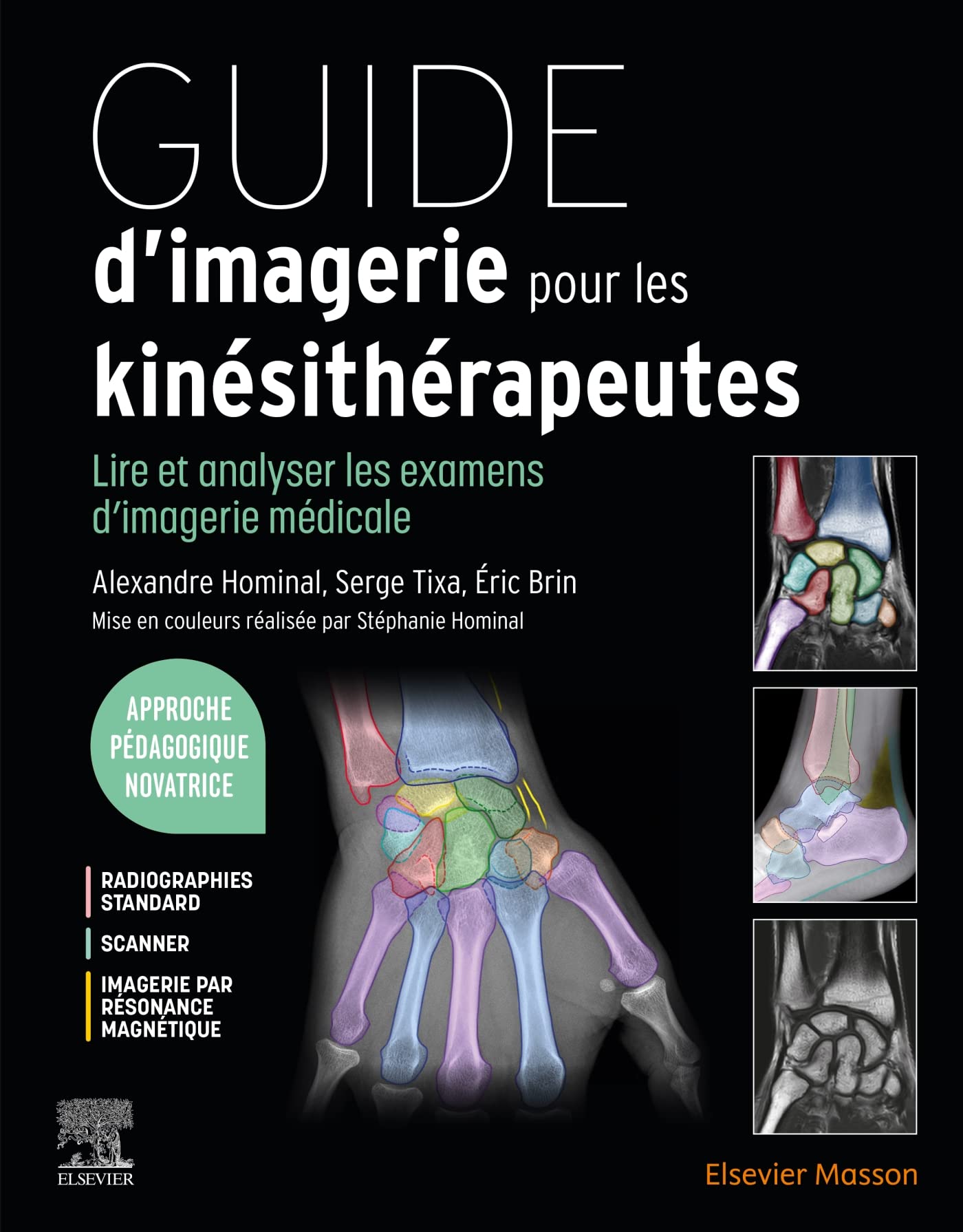 Guide d'imagerie pour les kinésithérapeutes: Lire et analyser les examens d'imagerie médicale Medicine