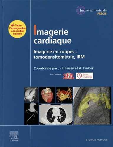 Imagerie cardiaque: Imagerie en coupes : scanner, IRM Medicine