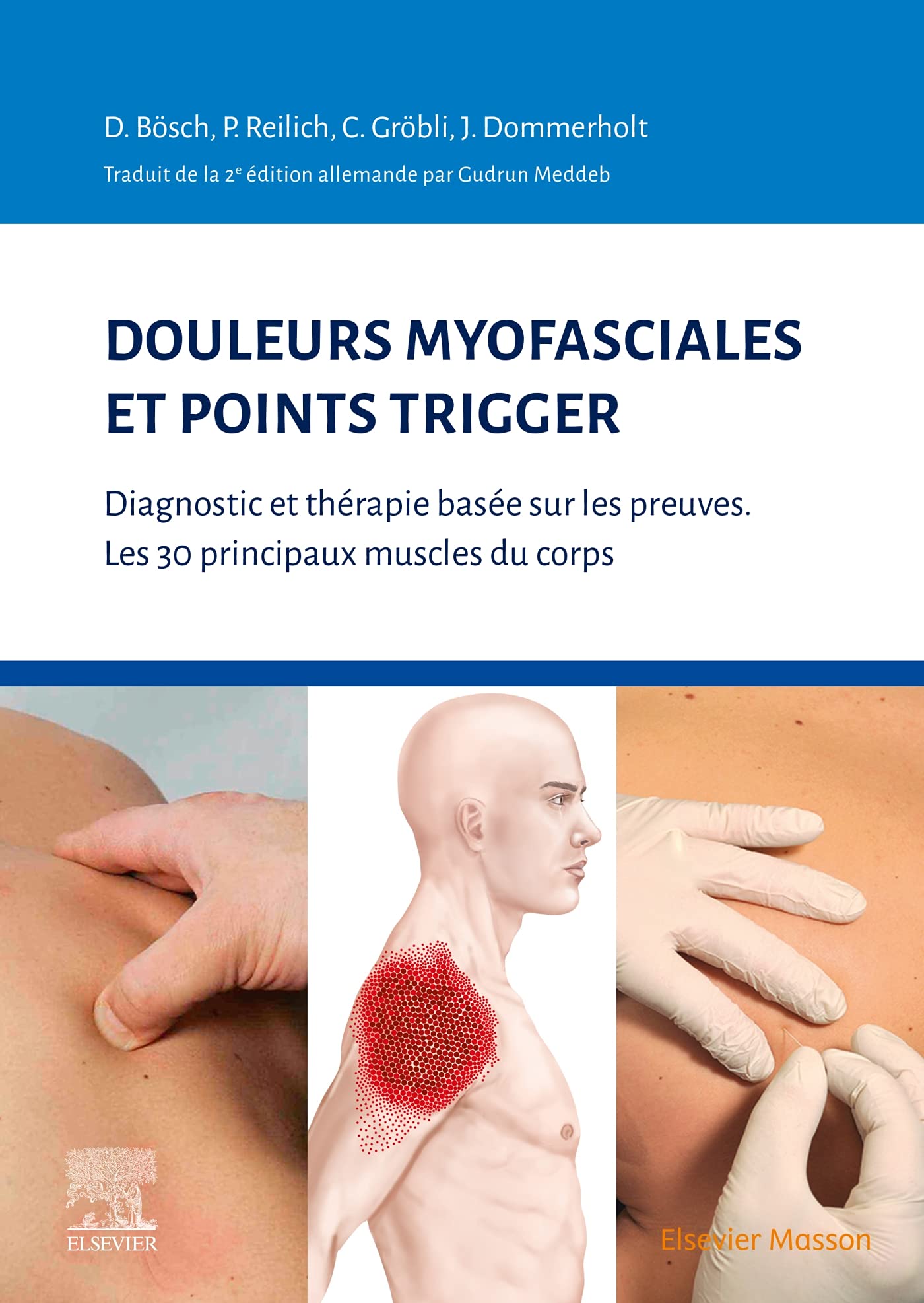 Douleurs myofasciales et points trigger: Diagnostic et thérapie basée sur les preuves. Les 30 principaux muscles du corps Medicine