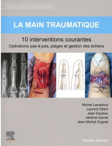 La main traumatique 10 interventions courantes: Manuel de chirurgie du membre supérieur Medicine