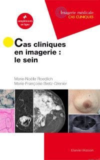 Cas cliniques en imagerie : le sein : + compléments en ligne Medicine