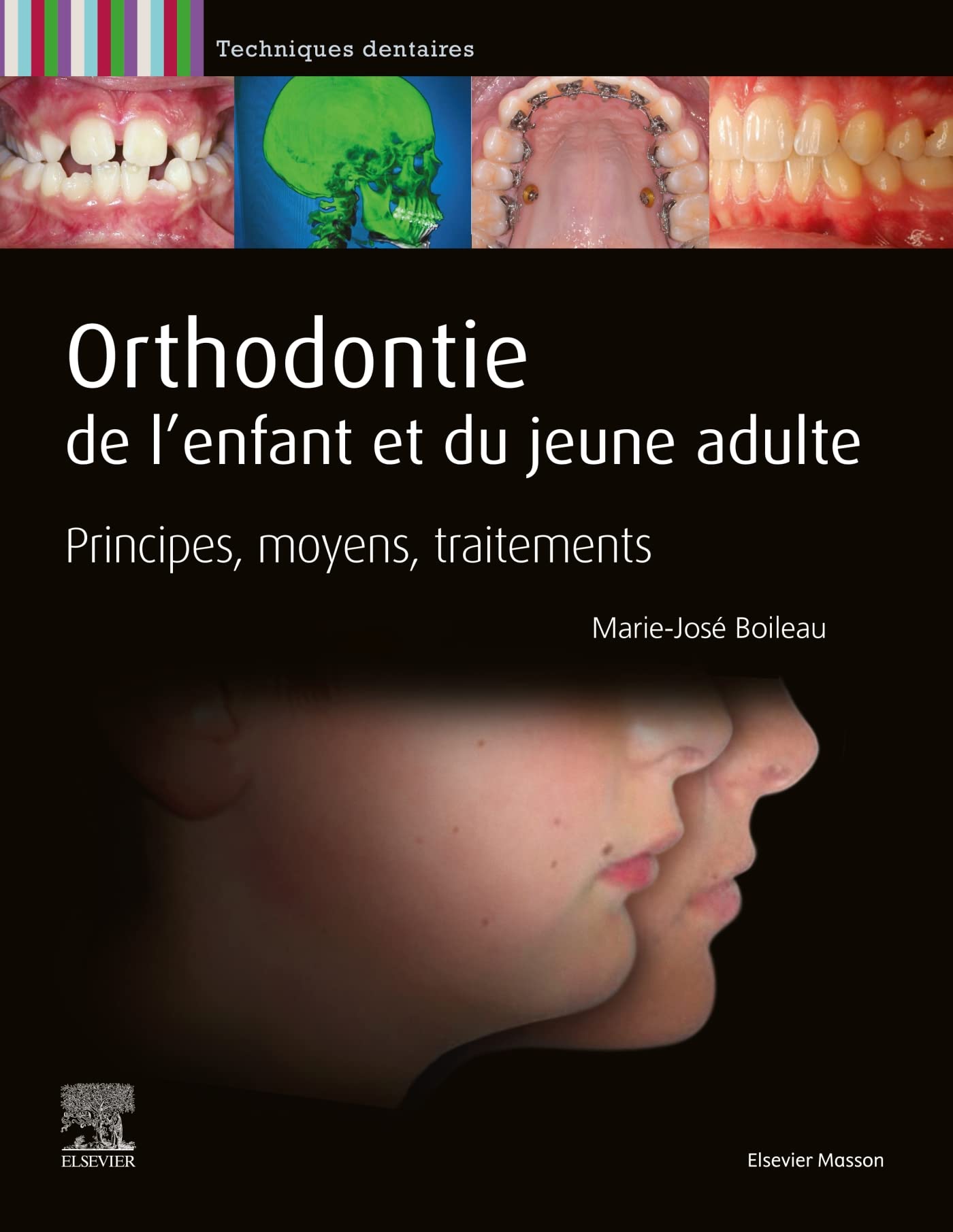 Orthodontie de l'enfant et du jeune adulte: Principes, moyens, traitements Medicine