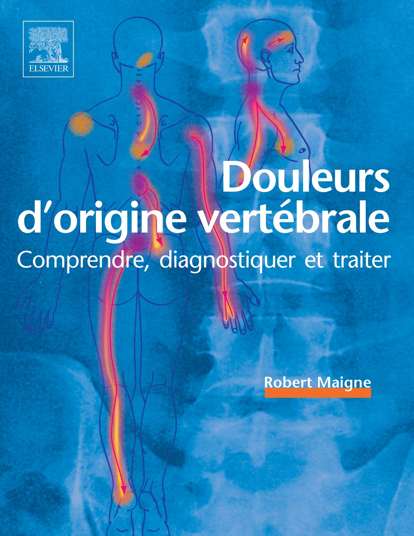 Douleurs d'origine vertébrale: Comprendre, diagnostiquer et traiter book