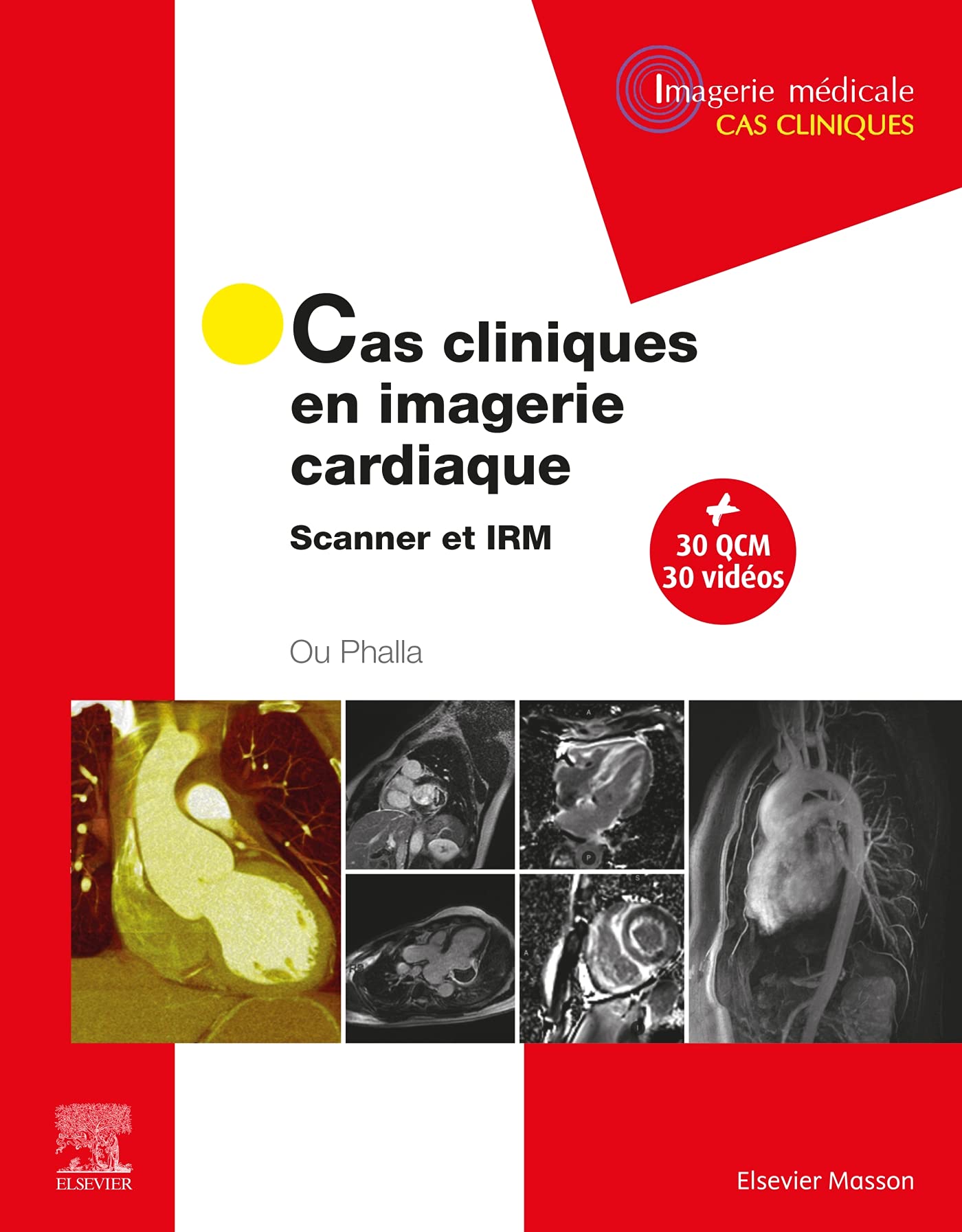 Cas cliniques en imagerie cardiaque: Scanner et IRM Medicine