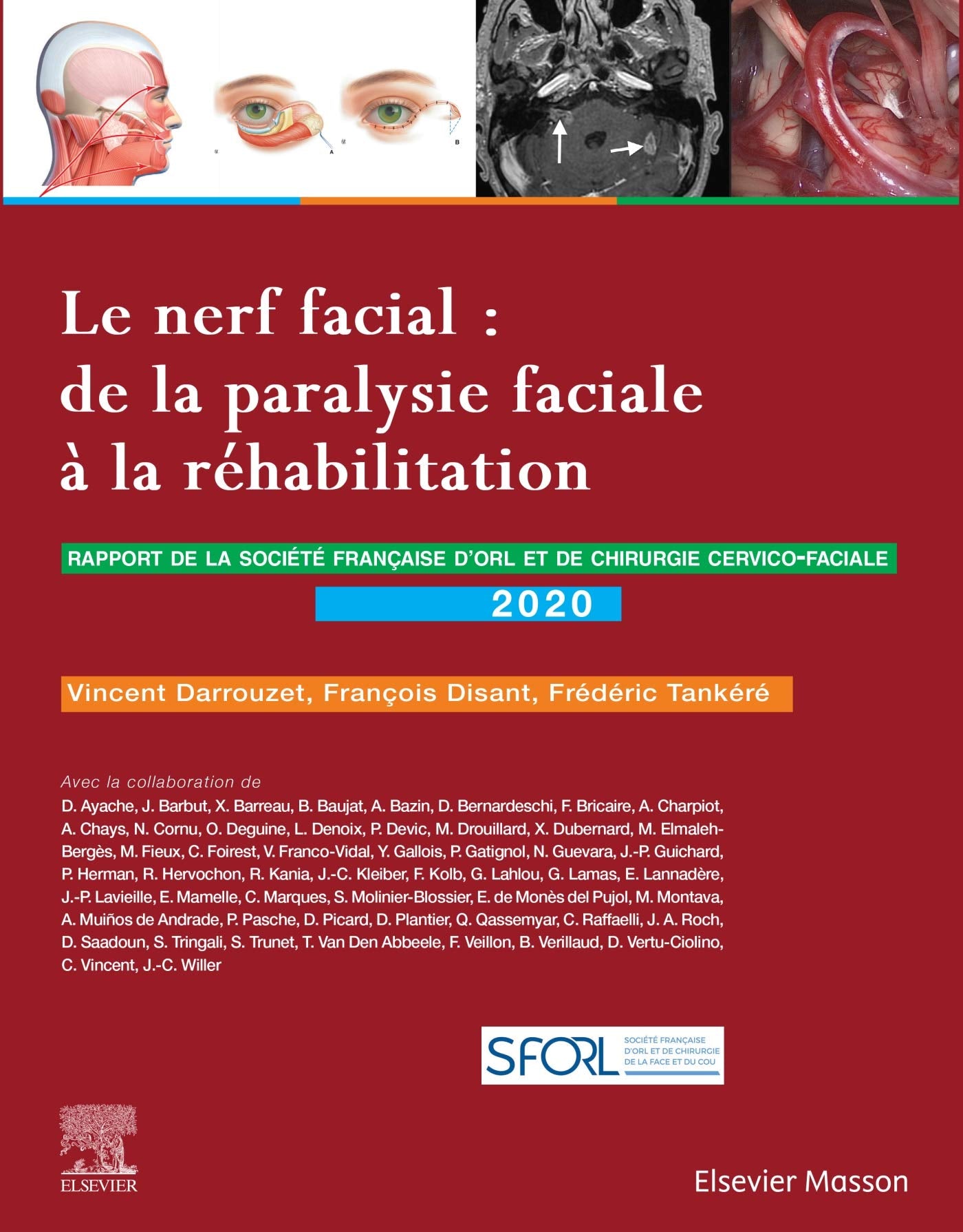 Le nerf facial : de la paralysie faciale à la réhabilitation: Rapport SFORL 2020 Medicine