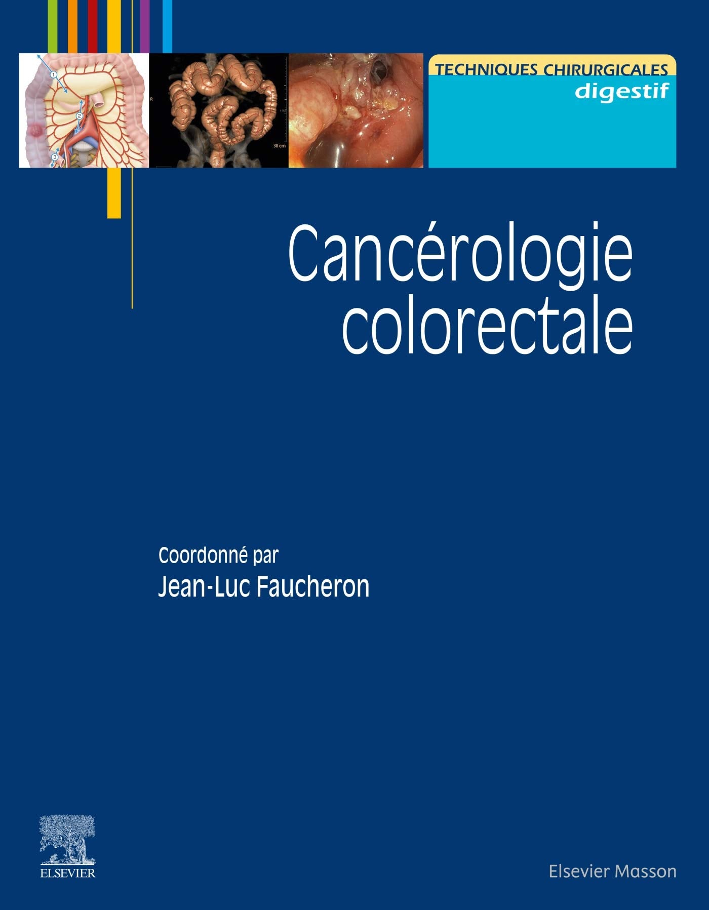 Cancérologie colorectale Medicine