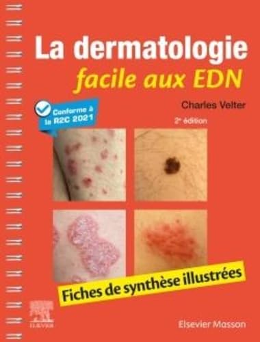 La dermatologie facile aux EDN: Fiches de synthèse illustrées Medicine