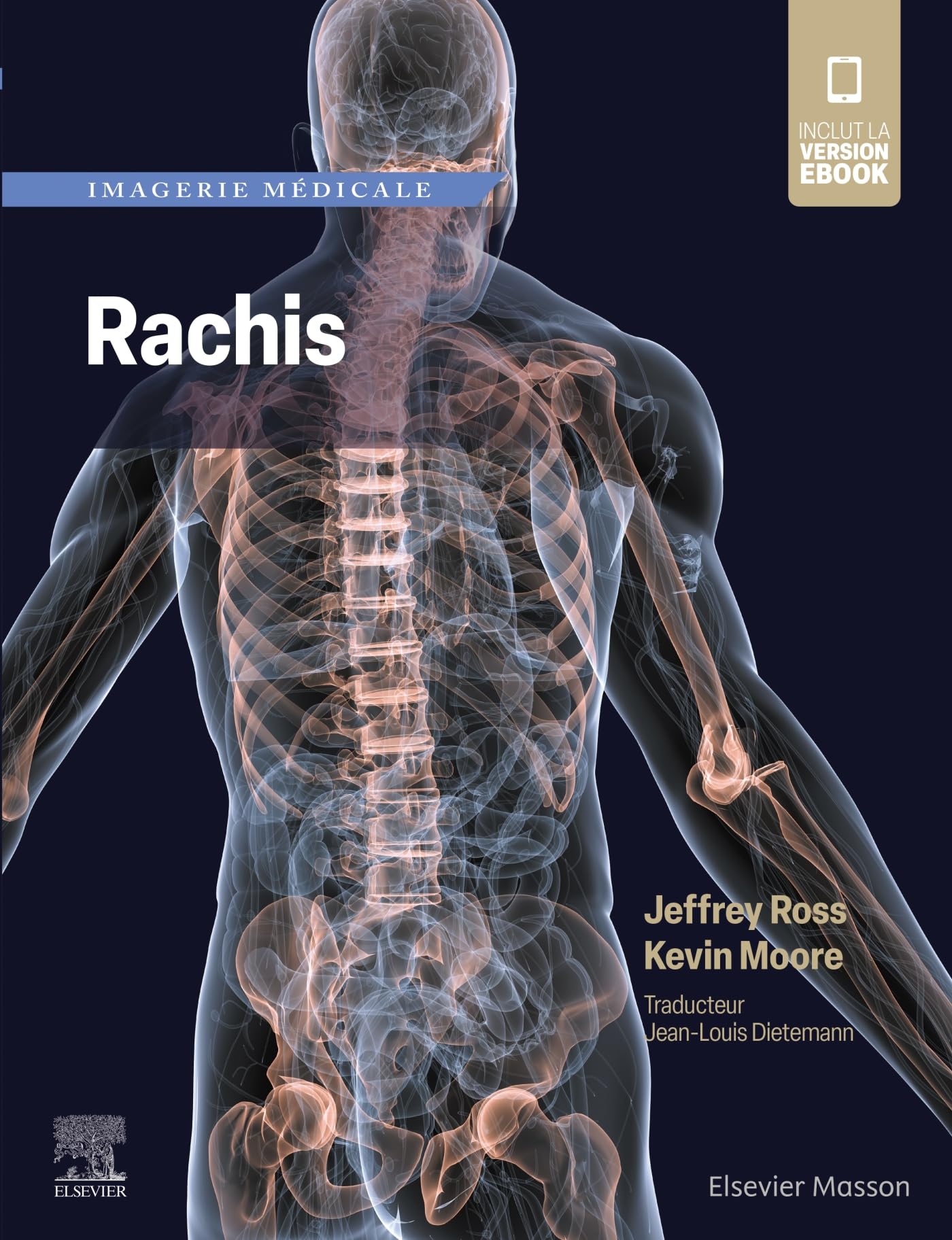 Imagerie médicale : Rachis Medicine