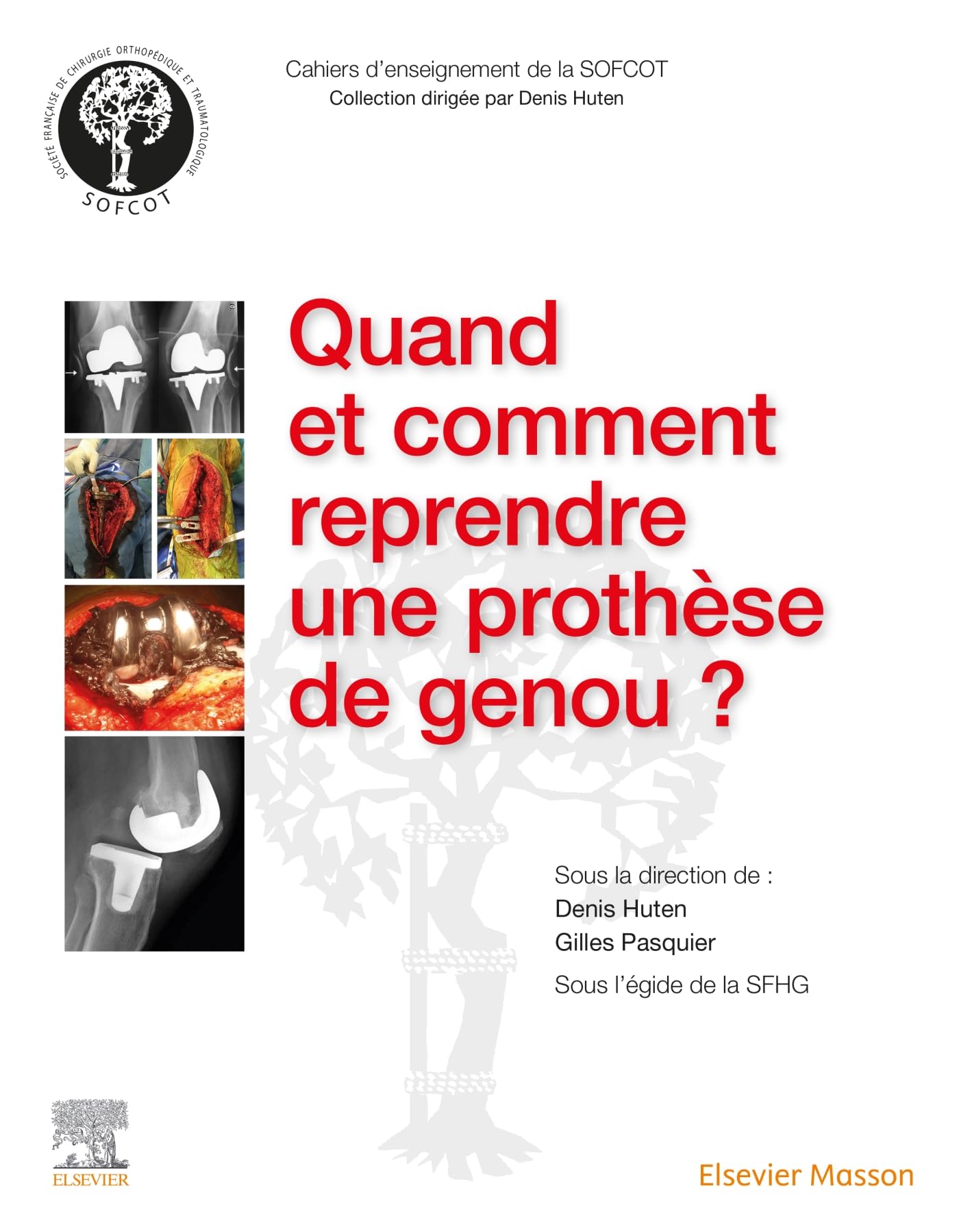 Quand et comment reprendre une prothèse de genou ? book