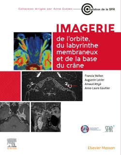 Imagerie de l'orbite, du labyrinthe membraneux et de la base du crâne book