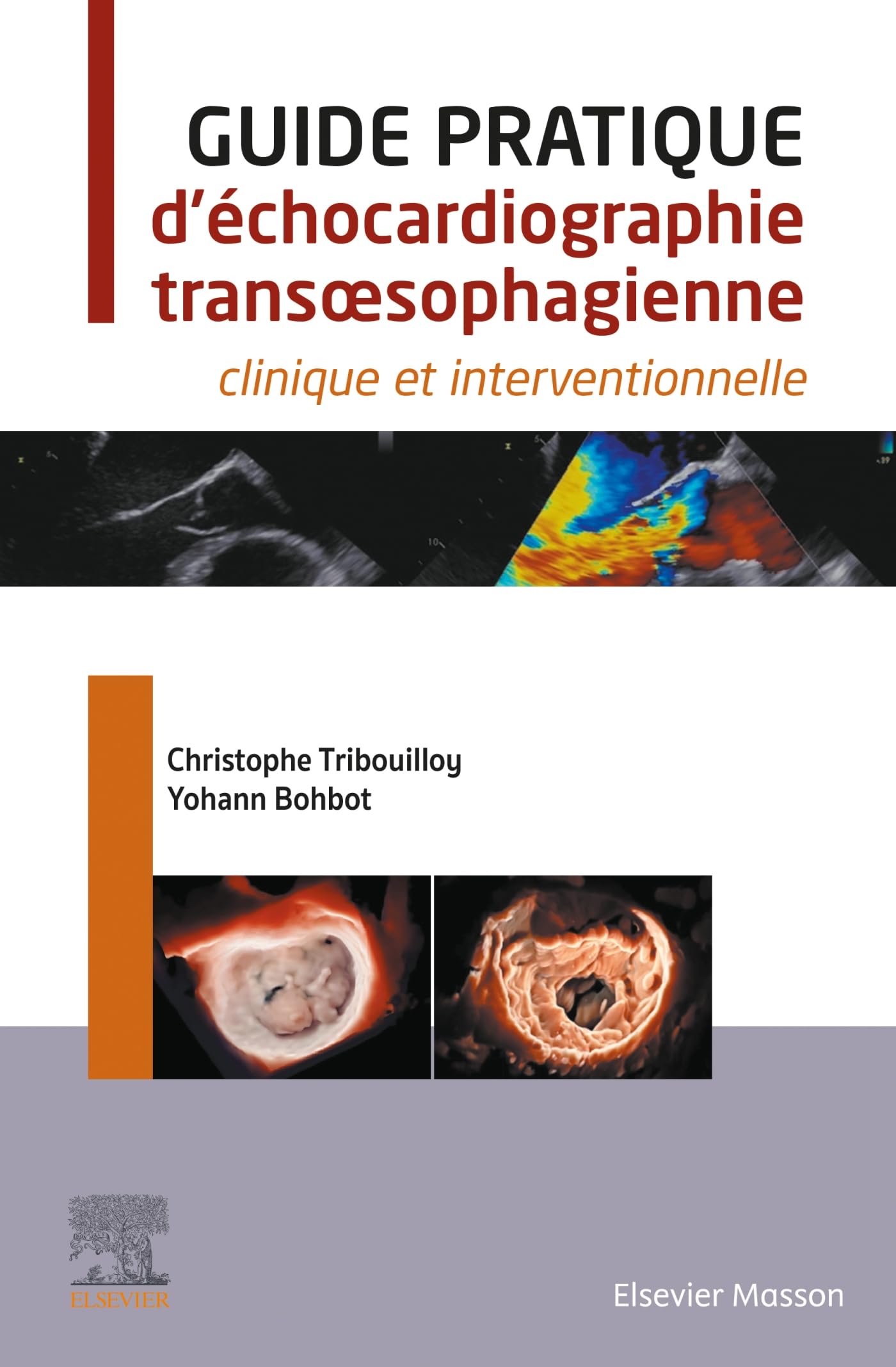 Guide pratique d'échocardiographie transoesophagienne: clinique et interventionnelle book