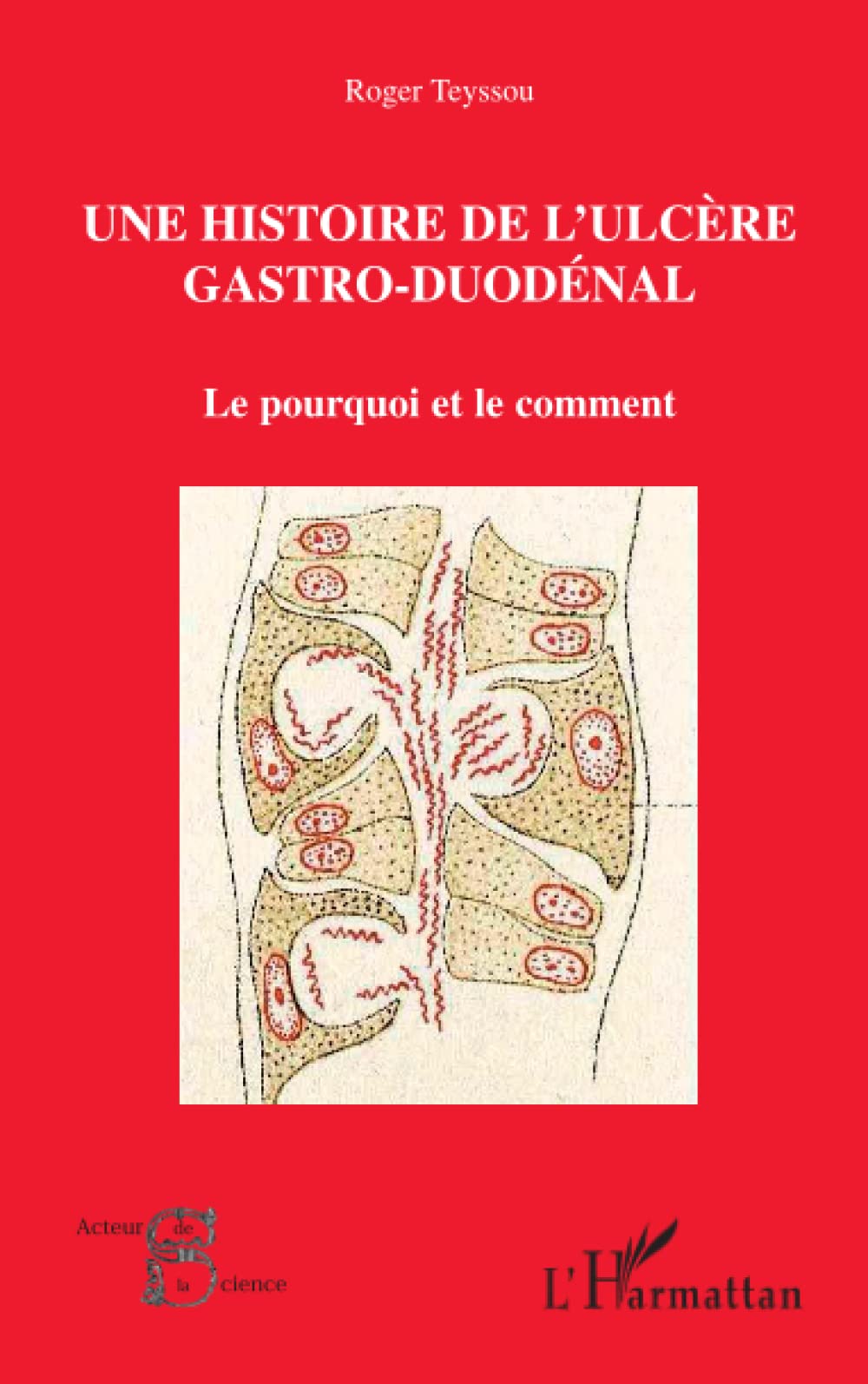Une histoire de l'ulcère gastro-duodénal: Le pourquoi et le comment book