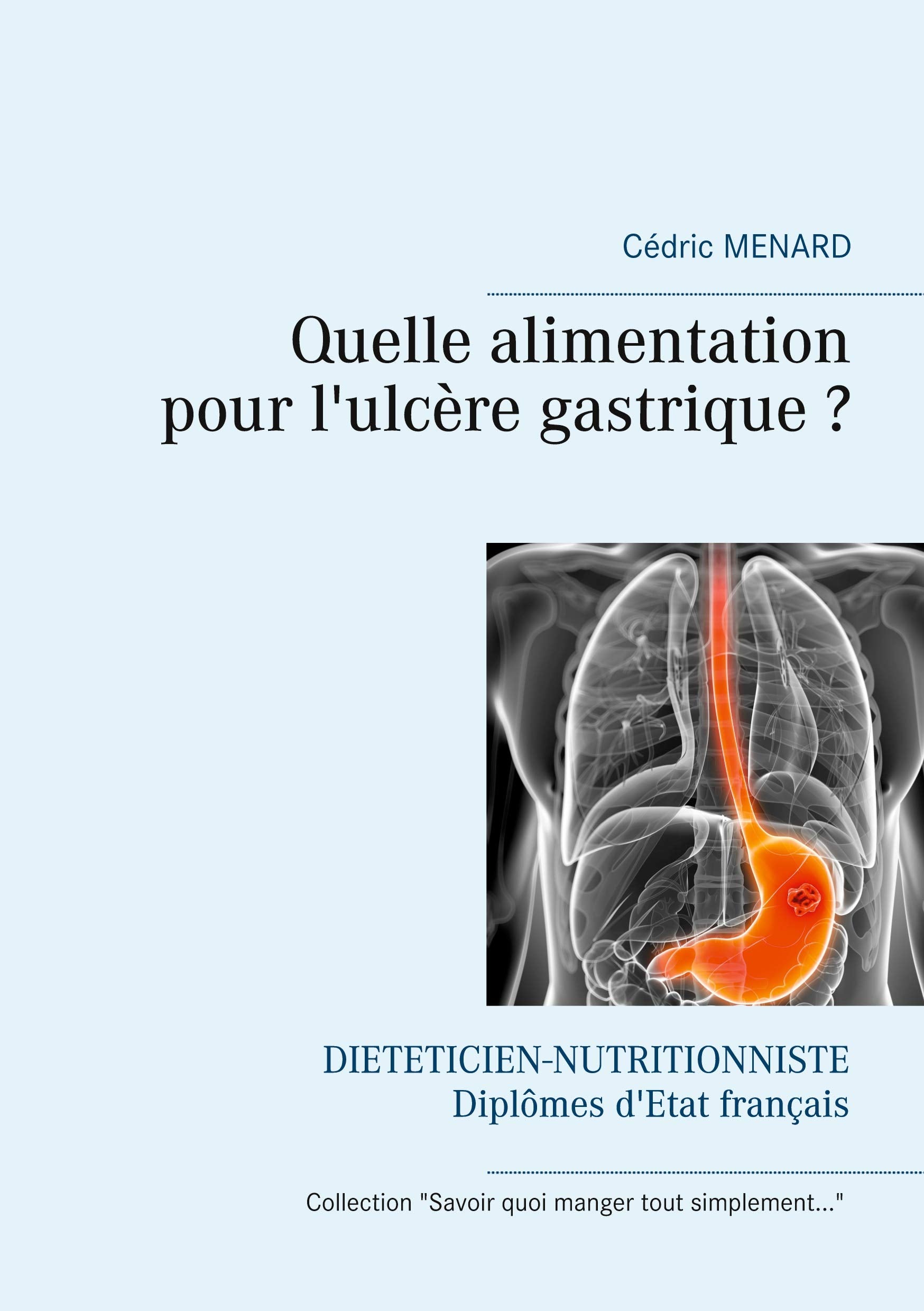 Quelle alimentation pour l'ulcère gastrique ? (Savoir quoi manger tout simplement...) Essays & Short Stories