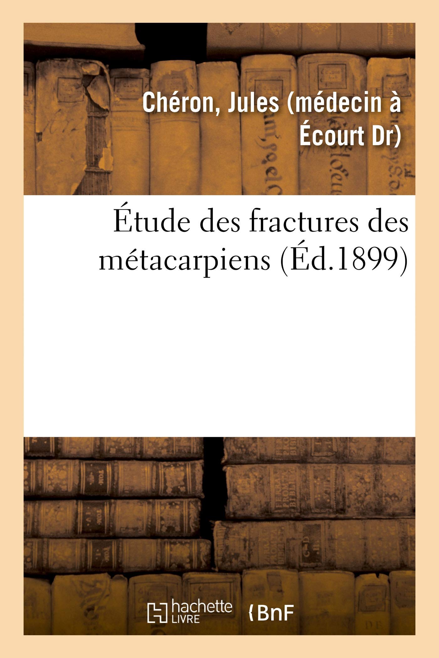 Étude des fractures des métacarpiens book