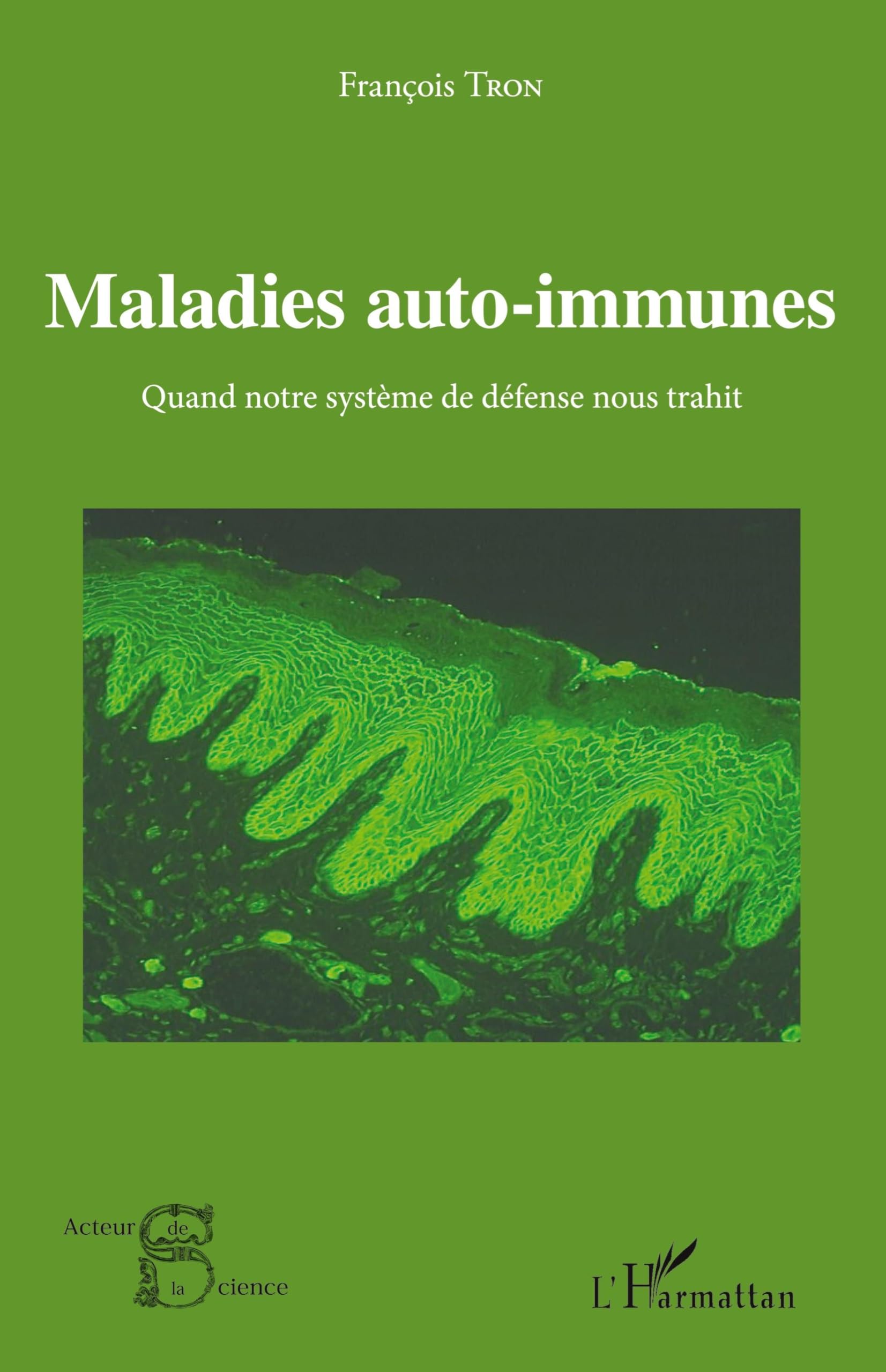 Maladies auto-immunes: Quand notre système de défense nous trahit book
