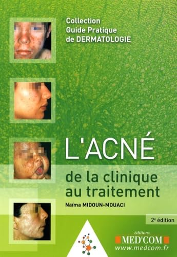 L ACNE 2E ED CLINIQUE AU TRAITEMENT (0000) book