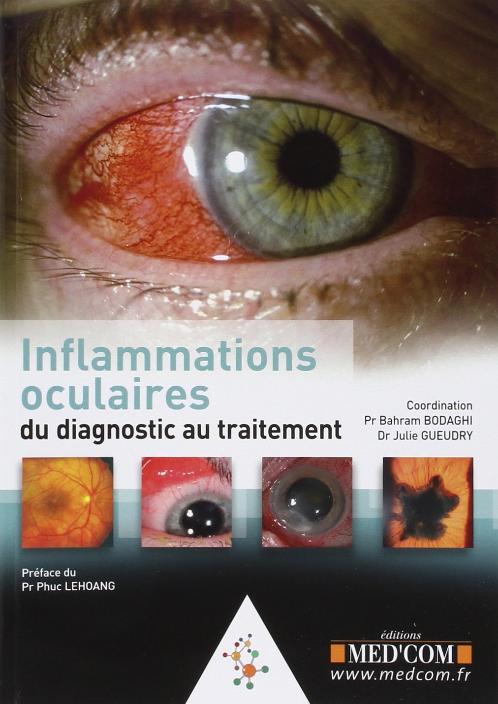 L'INFLAMMATION OCULAIRE -DE LA CLINIQUE AU TRAITEMENT (0000) book