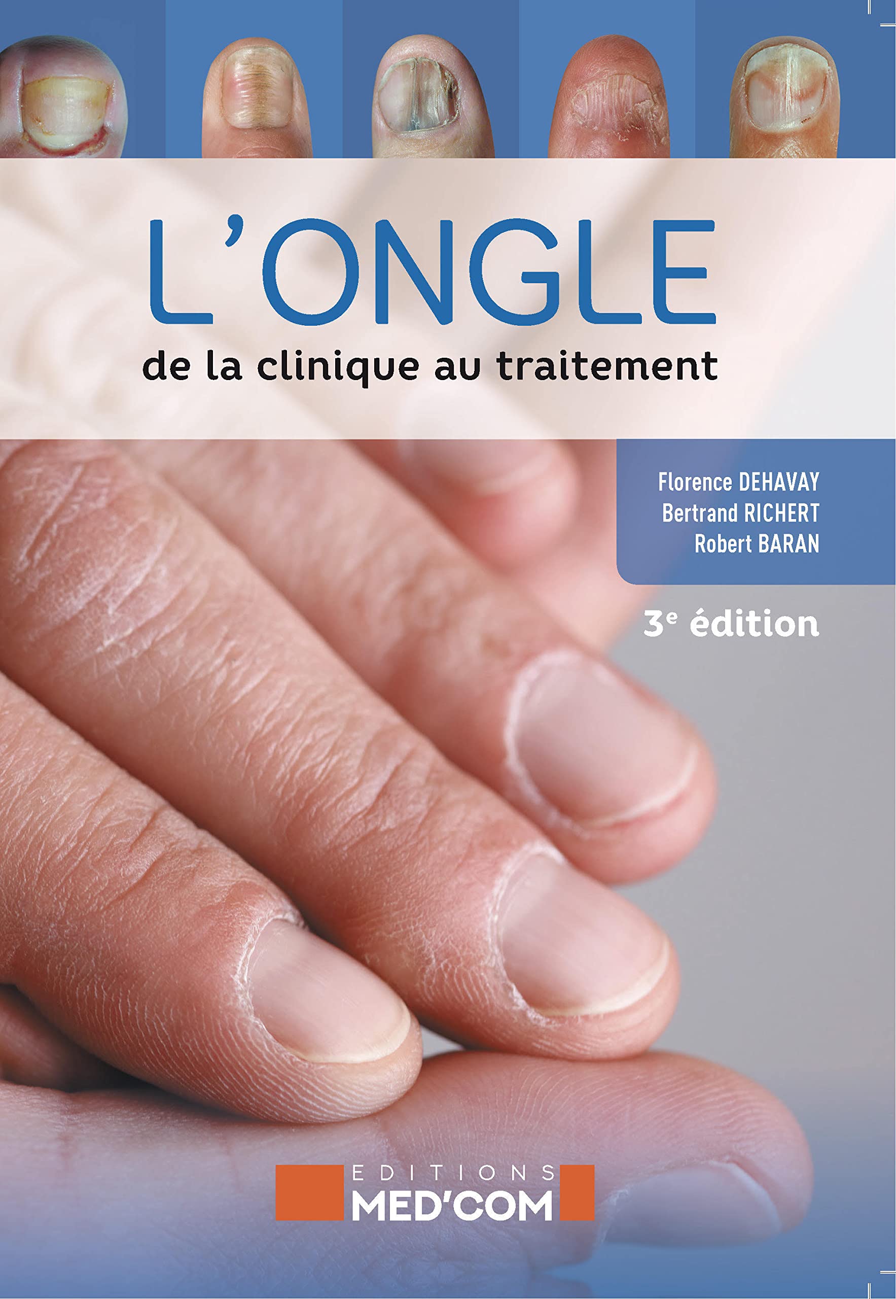 L'ongle : de la clinique au traitement. 3° ed book