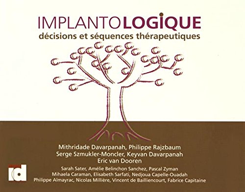 Implantologique: Décisions et séquences thérapeutiques Books
