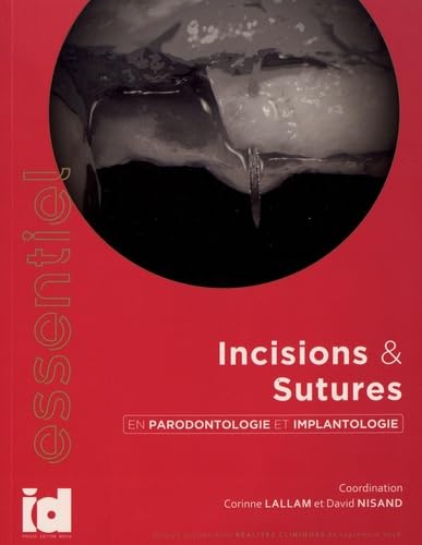 Incisions & sutures en parodontolologie et implantologie book