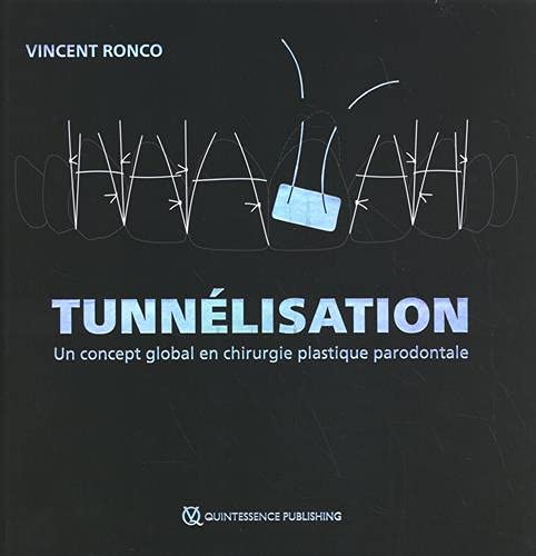 Tunnélisation: Un concept global en chirurgie plastique parodontale book
