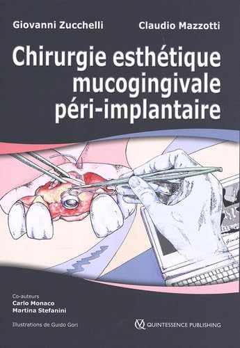 Chirurgie esthétique mucogingivale péri-implantaire: 2 volumes book