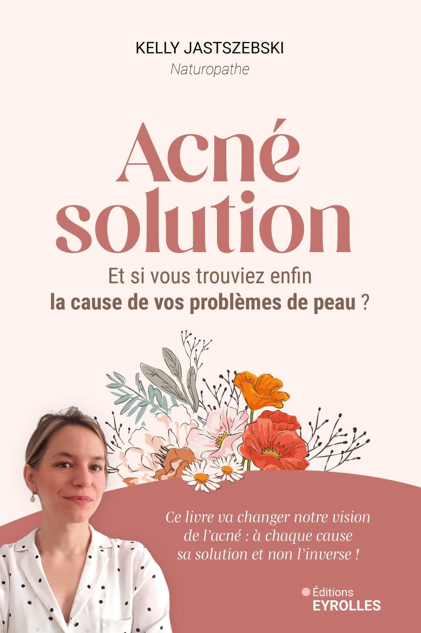 Acné solution: Et si vous trouviez enfin la cause de vos problèmes de peau ? book
