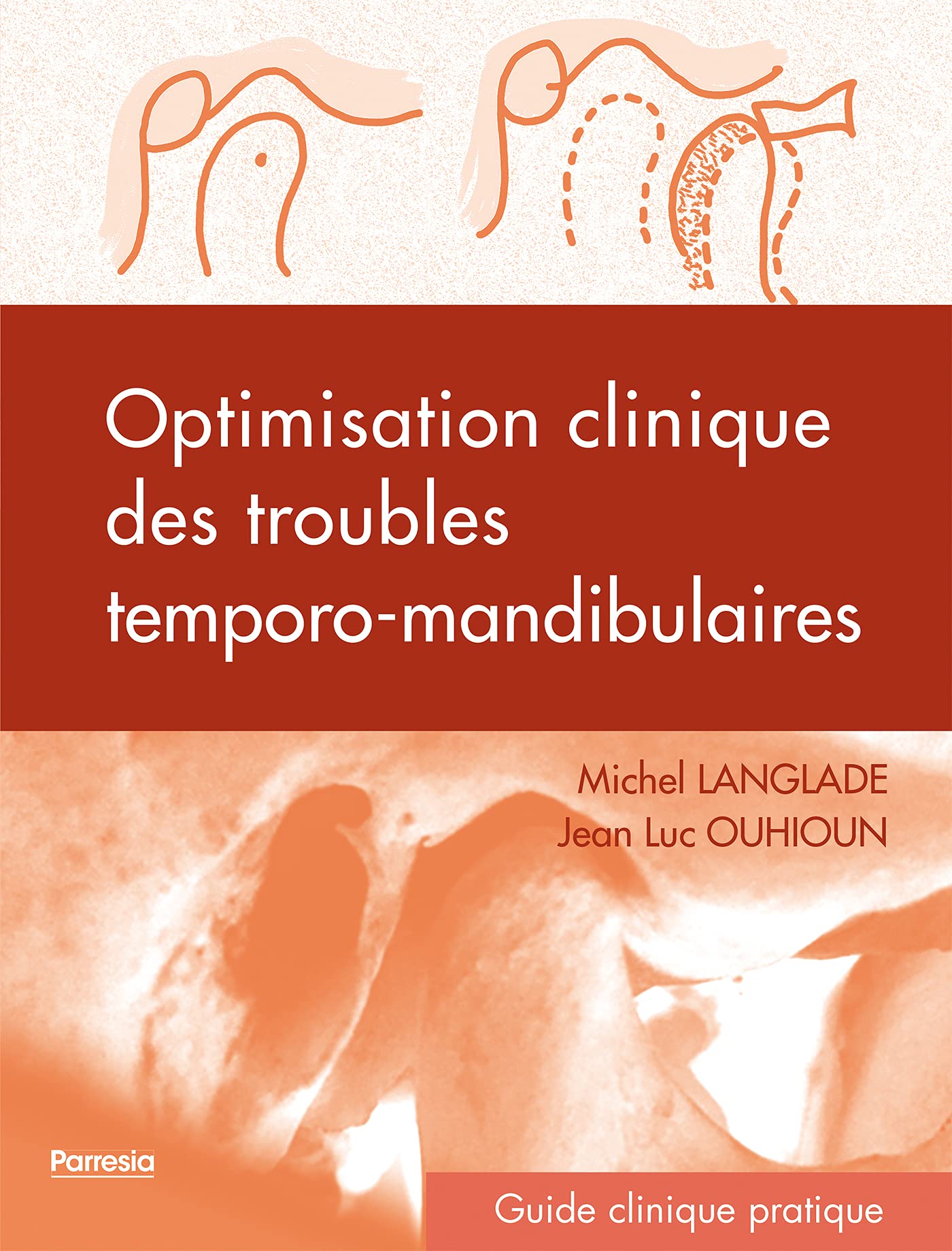 Optimisation clinique des troubles temporo-mandibulaires book
