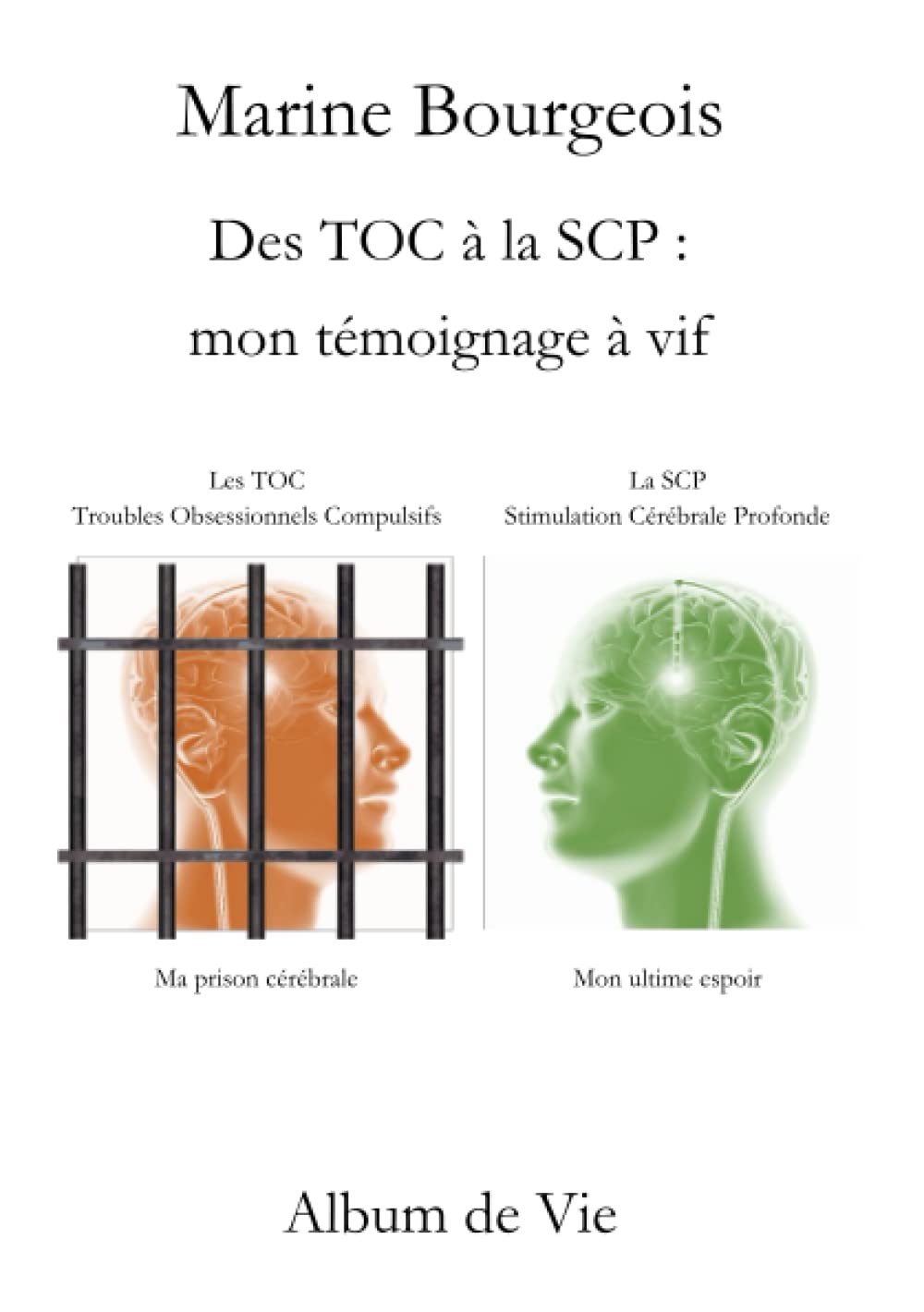 Des TOC à la SCP : mon témoignage à vif Science