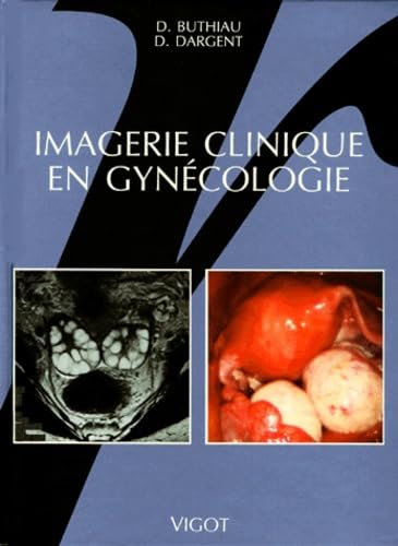 Imagerie clinique en gynécologie book
