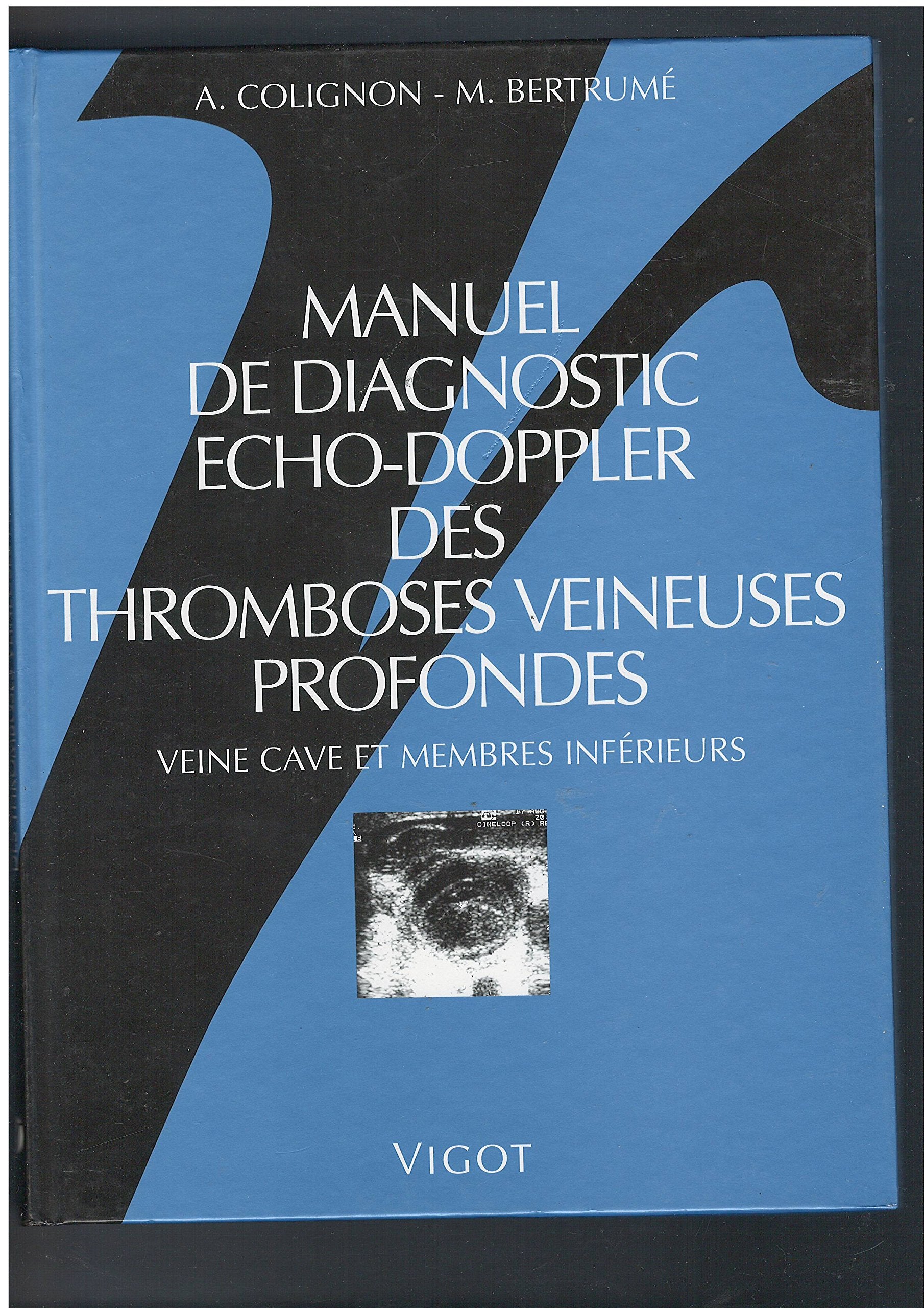 Manuel de diagnostic écho-doppler des thromboses veineuses profondes: Veine cave et membres inférieurs Books