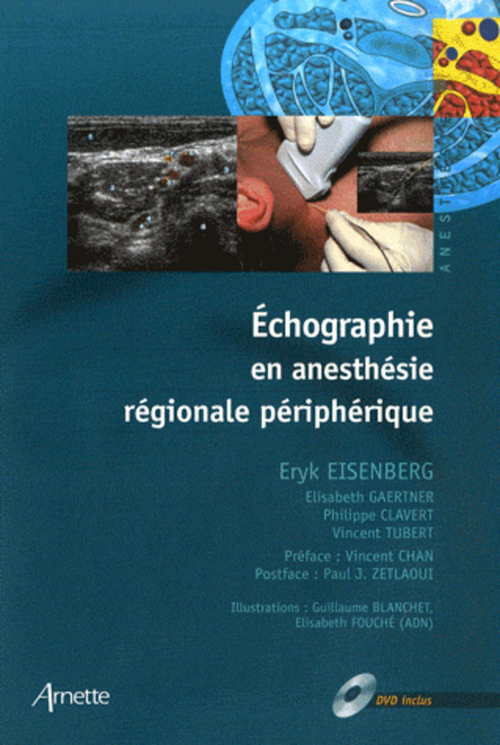 Echographie en anesthesie régionale périphérique book