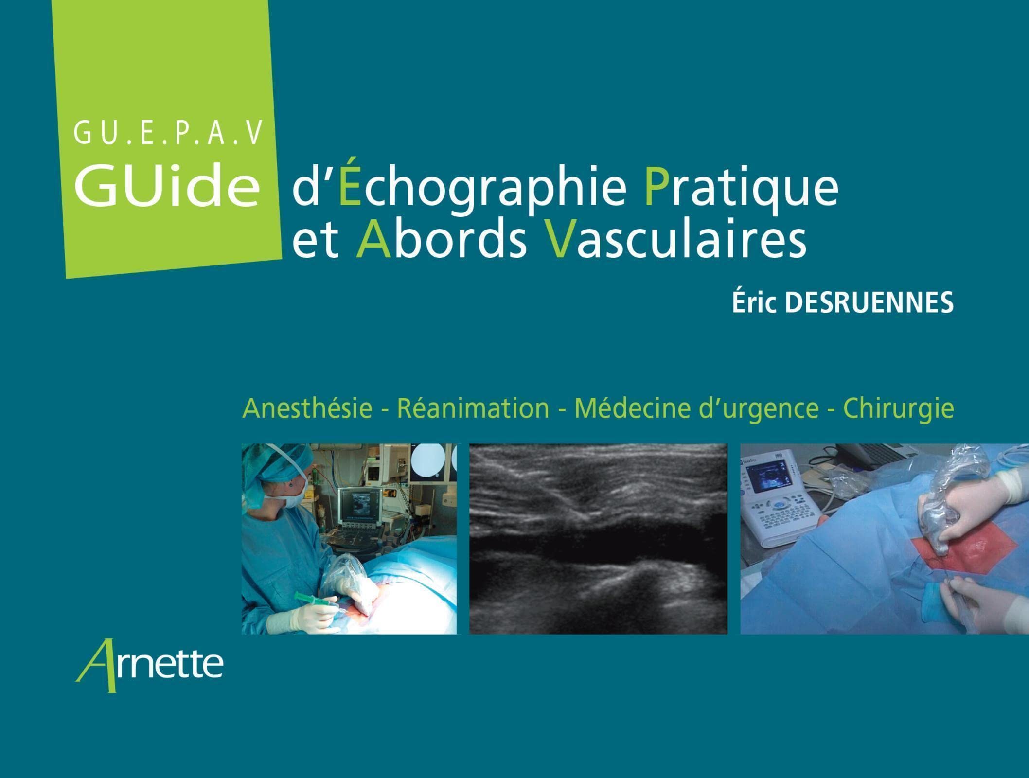 Guide d'Échographie Pratique et Abords Vasculaires (GU.E.P.A.V): Anesthésie - Réanimation - Médecine d'urgence - Chirurgie Medicine