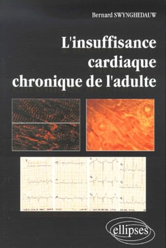 L'insuffisance cardiaque chronique de l'adulte book