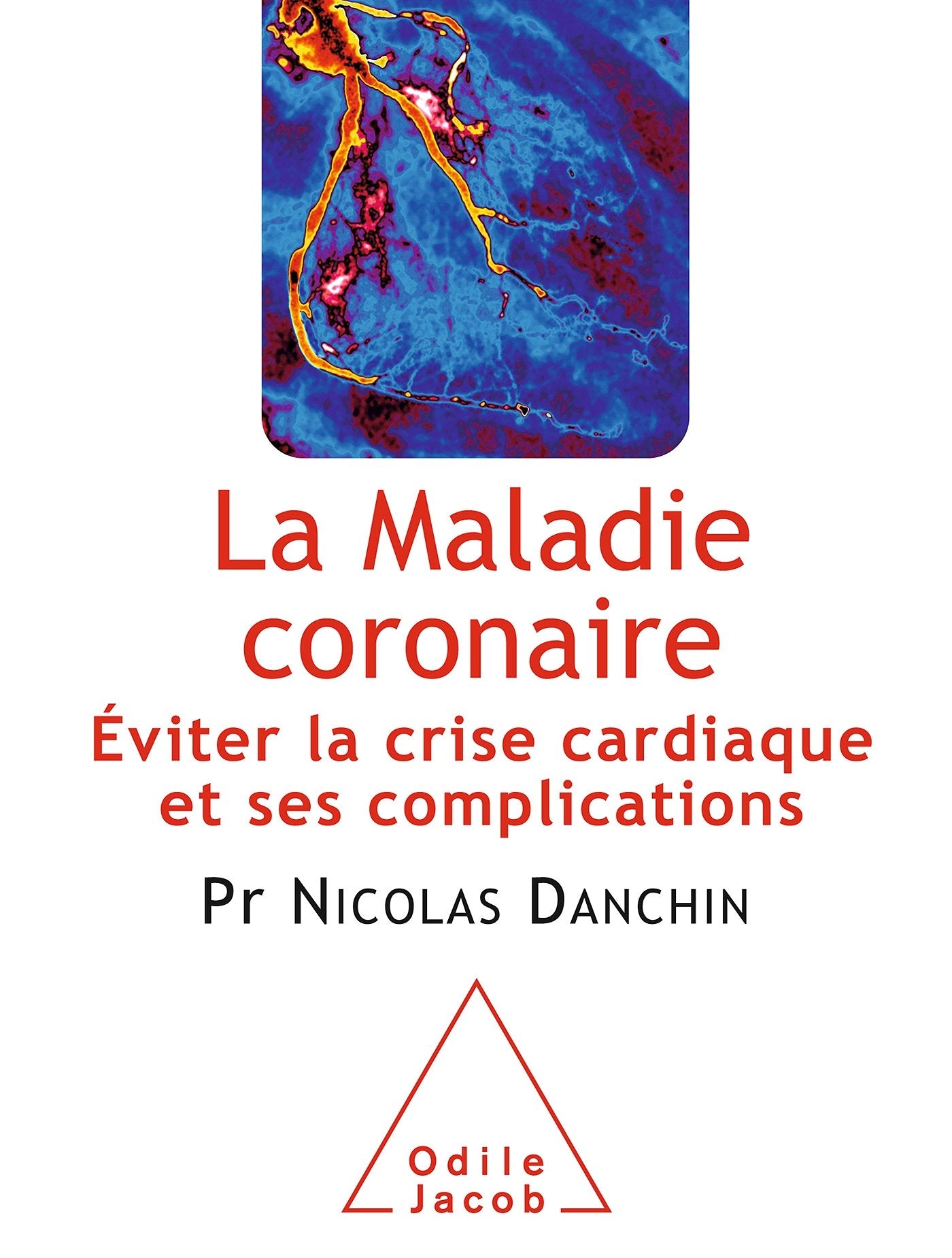 La Maladie coronaire: Éviter la crise cardiaque et ses complications Medicine